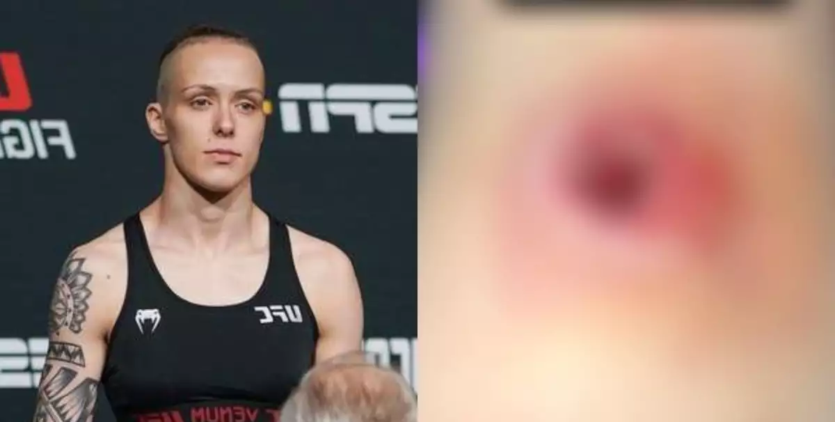 Ty kráso! Tereza Bledá odhaluje důvod zrušení dalšího UFC zápasu