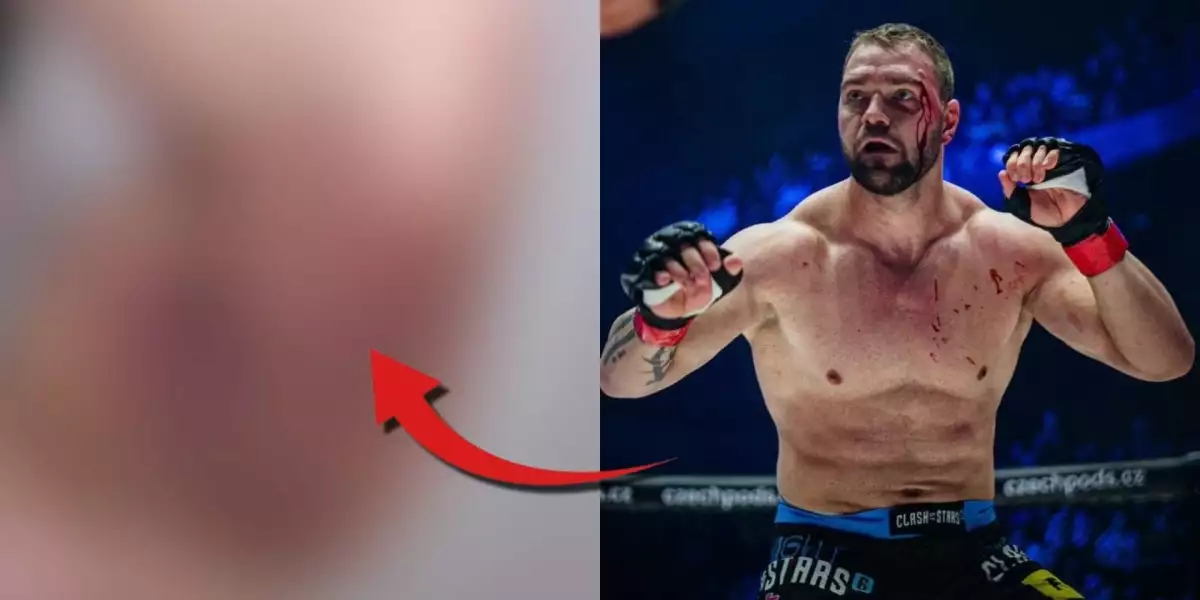 Ty kráso, co to je? Karlos Benda odhalil hodně ošklivé zranění